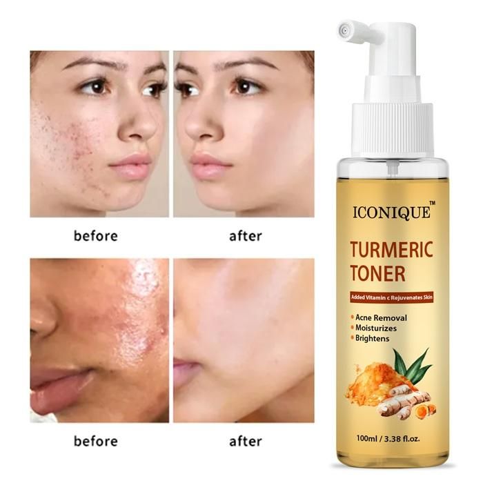 Turmeric Toner 100ML